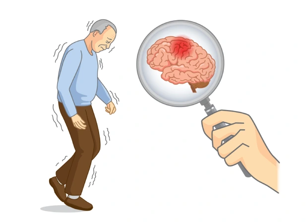 Best doctor for parkinsons in mumbai - Dr. Manish Baldia