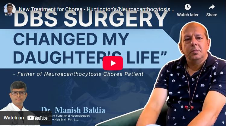 New Treatment for Chorea