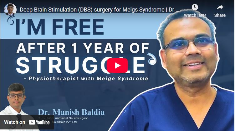Deep Brain Stimulation (DBS) surgery for Meigs Syndrome