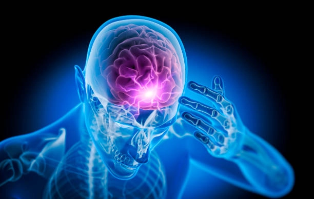 Advance Epilepsy Treatment
