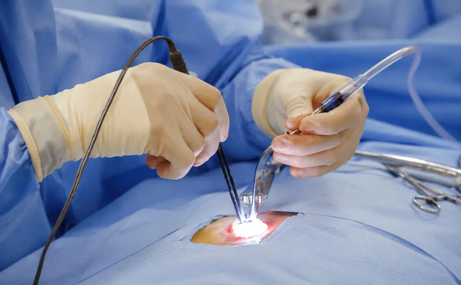 Minimally Invasive Spine Surgery